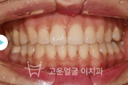 치료후기 이미지